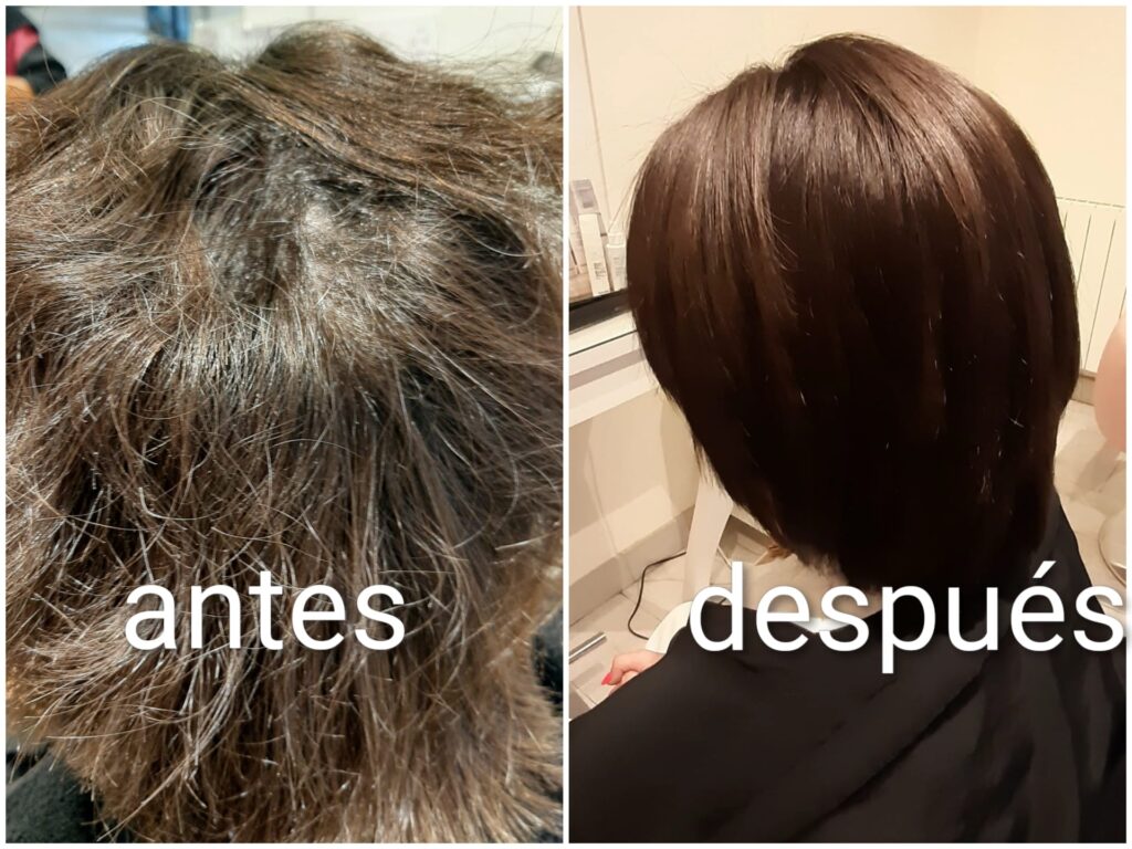 antes y después de una terapia de hidratación profunda