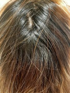 Resultado antes y después del tratamiento detox capilar ICON: cabello apagado vs. cabello sano y brillante”