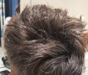 Cuero cabelludo sano y equilibrado: base para un cabello fuerte y bonito