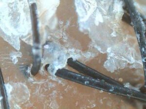 Diagnóstico capilar con microcámara: cuero cabelludo con caspa y deshidratado